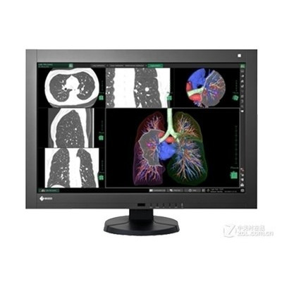 Eizo RadiForce RX440