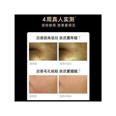 ��ʩ��QuasarMD Mask Pro